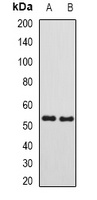 SUFU Rabbit Polyclonal Antibody