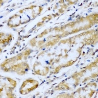 SUFU Rabbit Polyclonal Antibody
