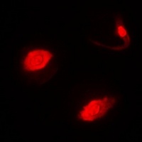 SUFU Rabbit Polyclonal Antibody