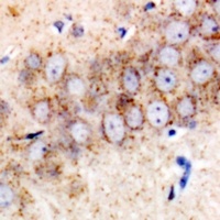 TMP21 Rabbit Polyclonal Antibody