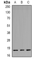 TPPP3 Rabbit Polyclonal Antibody