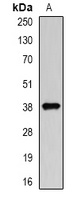 DCAF7 Rabbit Polyclonal Antibody