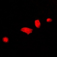 DCAF7 Rabbit Polyclonal Antibody
