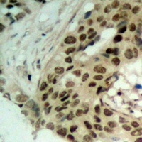 Exportin 5 Rabbit Polyclonal Antibody