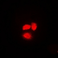 Exportin 5 Rabbit Polyclonal Antibody