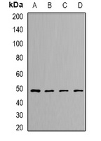 DLST Rabbit Polyclonal Antibody