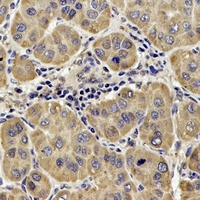 DLST Rabbit Polyclonal Antibody