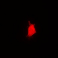 PARN Rabbit Polyclonal Antibody