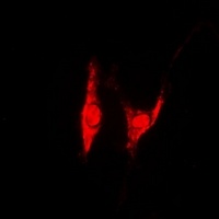 PSMD8 Rabbit Polyclonal Antibody