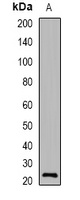 VILIP-1 Rabbit Polyclonal Antibody