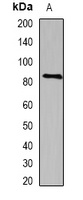 SEMA3B Rabbit Polyclonal Antibody