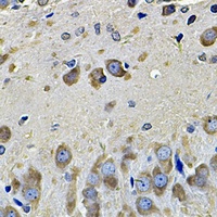 eIF3C Rabbit Polyclonal Antibody