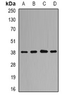 QKI Rabbit Polyclonal Antibody