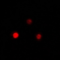 QKI Rabbit Polyclonal Antibody