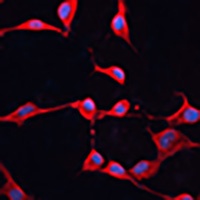DNAJA2 Rabbit Polyclonal Antibody