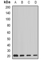 AGR2 Rabbit Polyclonal Antibody