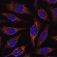AGR2 Rabbit Polyclonal Antibody