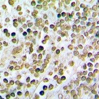 STAMBP Rabbit Polyclonal Antibody
