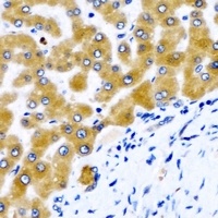 ALDH1L1 Rabbit Polyclonal Antibody