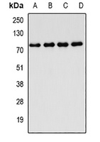 FIP1L1 Rabbit Polyclonal Antibody