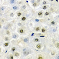 FIP1L1 Rabbit Polyclonal Antibody