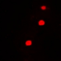 FIP1L1 Rabbit Polyclonal Antibody