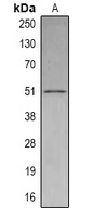 SETD6 Rabbit Polyclonal Antibody