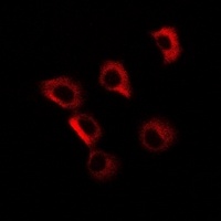 GP73 Rabbit Polyclonal Antibody