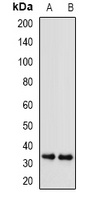 SGTA Rabbit Polyclonal Antibody