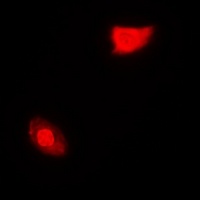 SGTA Rabbit Polyclonal Antibody