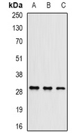 UBE2J2 Rabbit Polyclonal Antibody