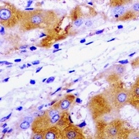 UBE2J2 Rabbit Polyclonal Antibody