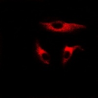 UBE2J2 Rabbit Polyclonal Antibody