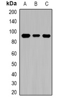 TGase1 Rabbit Polyclonal Antibody