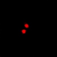 PRDM5 Rabbit Polyclonal Antibody