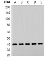 LHX6 Rabbit Polyclonal Antibody