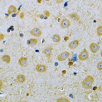 CaMK1 gamma Rabbit Polyclonal Antibody