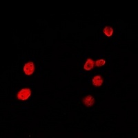 HRP2 Rabbit Polyclonal Antibody