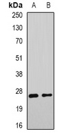 DNAJB9 Rabbit Polyclonal Antibody