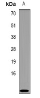 CRIP1 Rabbit Polyclonal Antibody