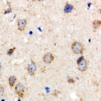 BCS1L Rabbit Polyclonal Antibody