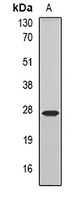 COQ7 Rabbit Polyclonal Antibody