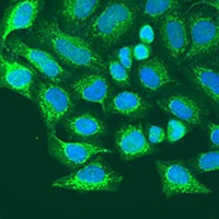 Metaxin-1 Rabbit Polyclonal Antibody