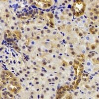DDX39A Rabbit Polyclonal Antibody