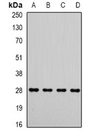 Metaxin-2 Rabbit Polyclonal Antibody