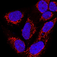 Metaxin-2 Rabbit Polyclonal Antibody