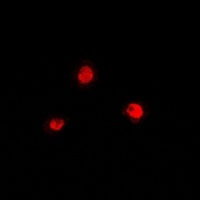 PRDM7 Rabbit Polyclonal Antibody