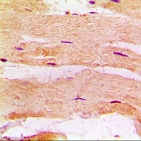MBNL1 Rabbit Polyclonal Antibody