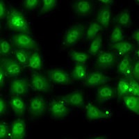 MBNL1 Rabbit Polyclonal Antibody