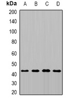 MTCH1 Rabbit Polyclonal Antibody